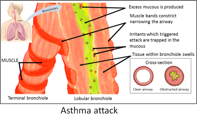 How Does Aloe Vera Juice Work for Asthma